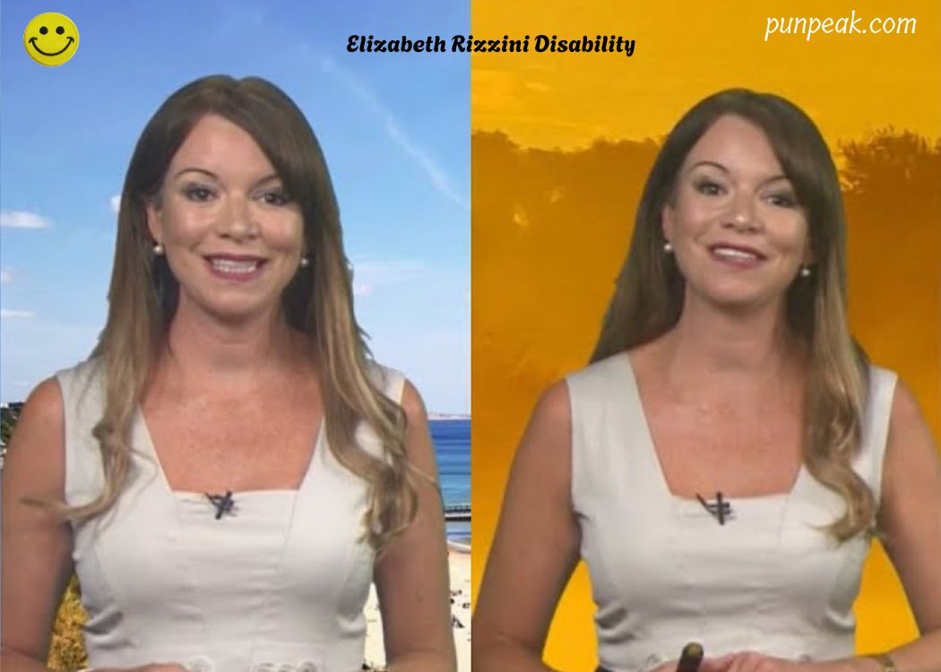 Elizabeth Rizzini Disability